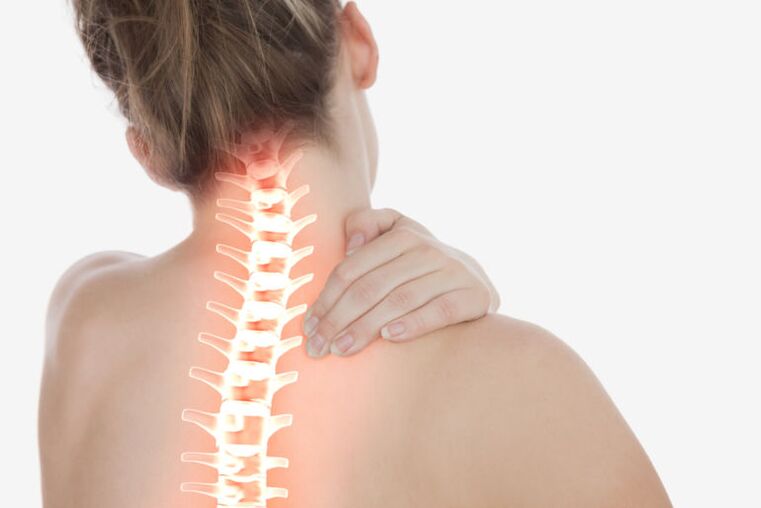 osteochondróza krční páteře